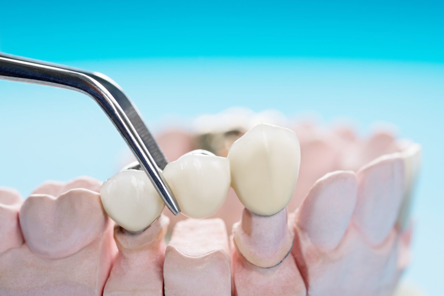 Dentures